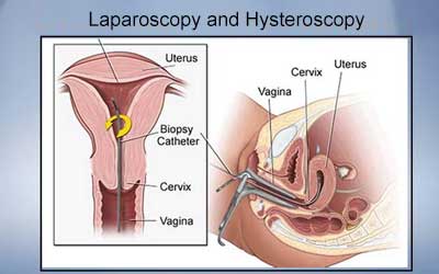 ivf services